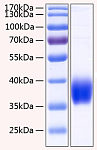 Recombinant Human Carbonic anhydrase 12 Protein (RP00157)