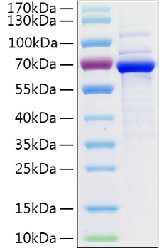Recombinant Human 5'-Nucleotidase/CD73 Protein