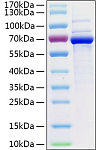 Recombinant Human 5'-Nucleotidase/CD73 Protein (RP00160)