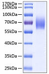 Recombinant Human IL-18BP Protein (RP00162)