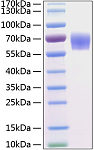 Recombinant Human BACE-1/ASP2 Protein (RP00165)