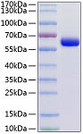 Recombinant Human JAM-3(A149P) Protein (RP00170)