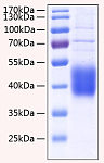 Recombinant Human IL-21R/CD360 Protein (RP00177)