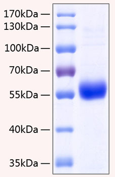 Recombinant Human TNFRSF11B/Osteoprotegerin Protein