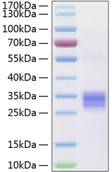 Active Recombinant Human TNFSF11/RANKL/CD254 Protein