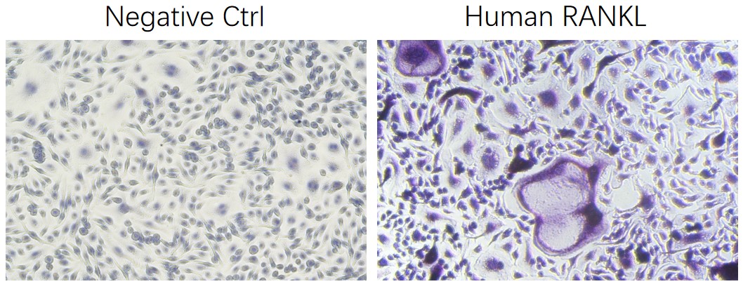 Recombinant Human TNFSF11/RANKL/CD254 Protein