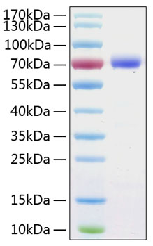 Recombinant Human B7-H1/PD-L1/CD274 Protein