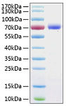 Recombinant Human B7-H1/PD-L1/CD274 Protein (RP00184)