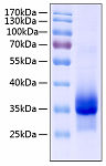 Recombinant Human IGFBP-4 Protein (RP00185)