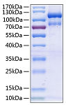 Recombinant Human EphA3 Protein (RP00186)