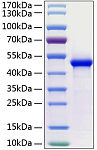 Recombinant Human WIF-1(Q166K) Protein (RP00190)