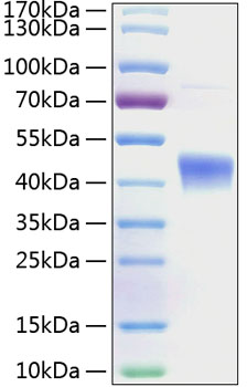Recombinant Human IL-22RA2/IL22BP Protein
