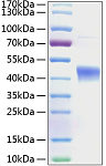 Recombinant Human IL-22RA2/IL22BP Protein (RP00192)