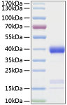 Recombinant Human Azurocidin/CAP37/AZU1 Protein (RP00196)