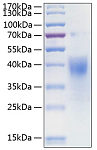 Recombinant Human IFN-gamma R1/CD119 Protein (RP00200)