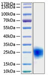 Recombinant Human Cripto-1/TDGF1 Protein (RP00202)