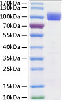 Recombinant Human TYRO3 Protein (RP00203)