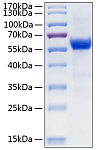 Recombinant Human Frizzled-7/FZD7 Protein (RP00204)