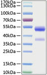 Recombinant Human Angiopoietin-like 7/ANGPTL7 Protein (RP00206)