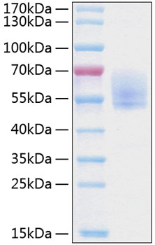 Recombinant Human Podoplanin/PDPN Protein