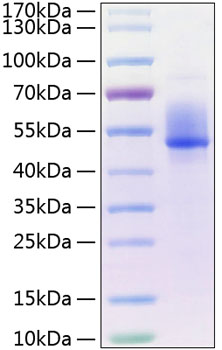 Recombinant Human Dkk-3 Protein
