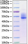 Recombinant Human Dkk-3 Protein (RP00209)