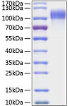 Recombinant Human EGFR Protein (RP00210)