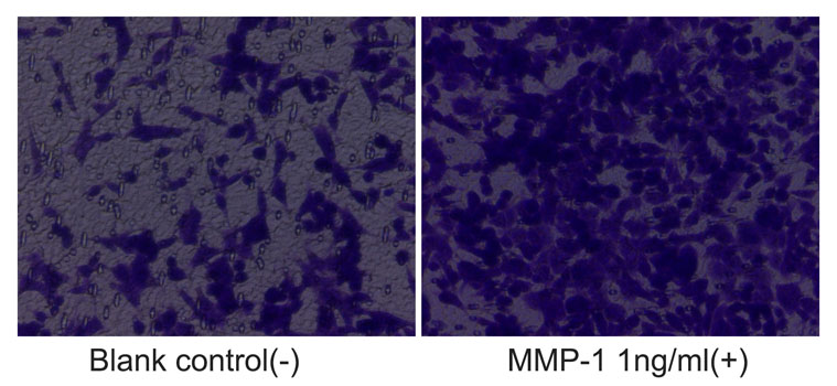 Recombinant Human MMP-1 Protein