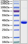 Recombinant Human IGFBP-2 Protein (RP00215)