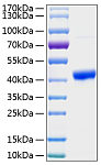 Recombinant Human Osteonectin/SPARC Protein (RP00217)