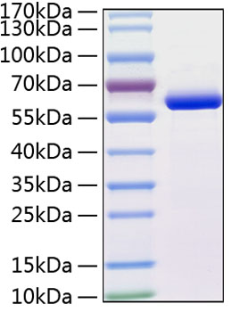 Recombinant Human MMP-13 Protein