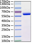 Recombinant Human MMP-13 Protein (RP00221)