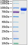 Recombinant Human Hedgehog-interacting protein/HHIP Protein (RP00230)