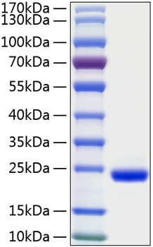 Recombinant Human IFN-lambda 2/IL-28A Protein