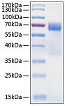 Recombinant Human TIM-3/HAVCR2/CD366 Protein (RP00234)