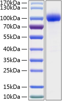 Recombinant Human IL-1R2/IL-1RT2/CD121b Protein
