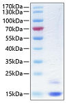 Recombinant Human Cystatin-M/CST6 Protein (RP00236)