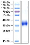 Recombinant Human CD2 Protein (RP00241)
