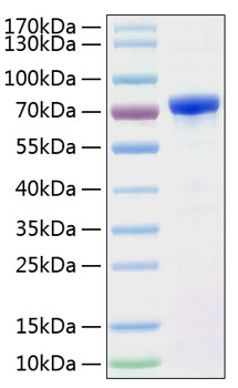 Recombinant Human Alpha-fetoprotein/AFP Protein