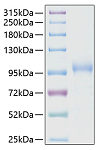 Recombinant Human CDH6/K-Cadherin Protein (RP00244)