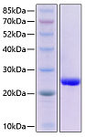 Recombinant Human Serum Amyloid P/SAP Protein (RP00245)