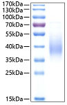 Recombinant Human Fc epsilon RI alpha Protein (RP00246)
