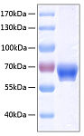 Recombinant Human Ephrin-B1/EFNB1 Protein (RP00250)