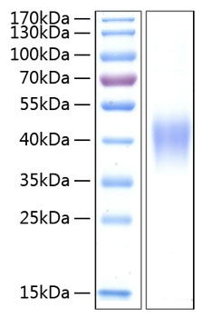 Recombinant Human TNFRSF1B/TNF-R2/CD120b Protein