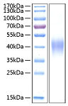 Recombinant Human TNFRSF1B/TNF-R2/CD120b Protein (RP00252)
