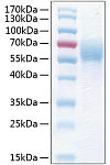Recombinant Human THSD1 Protein (RP00253)