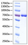 Recombinant Human Serum albumin/ALB Protein (RP00254)