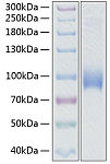 Recombinant Human SELL/L-selectin/LAM-1/CD62L Protein (RP00255)