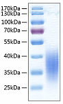Recombinant Human B7-H5/Gi24/VISTA Protein (RP00259)