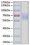 Recombinant Human LMIR1/CD300a Protein (RP00265)